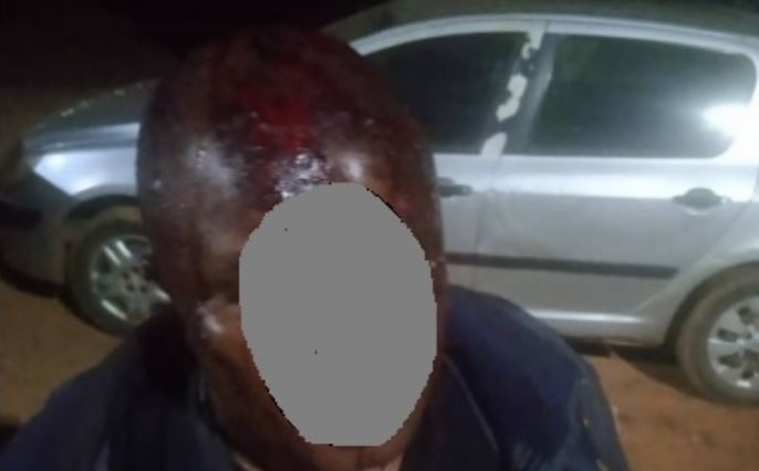 Un braquage survenu au domicile de l’intendant du Palais présidentiel